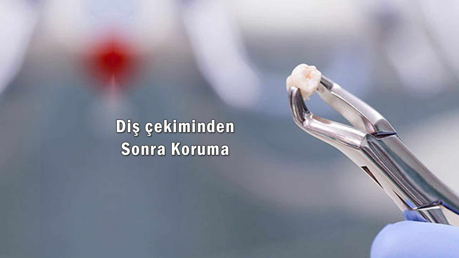 Diş Çekimi Sonrası Koruma